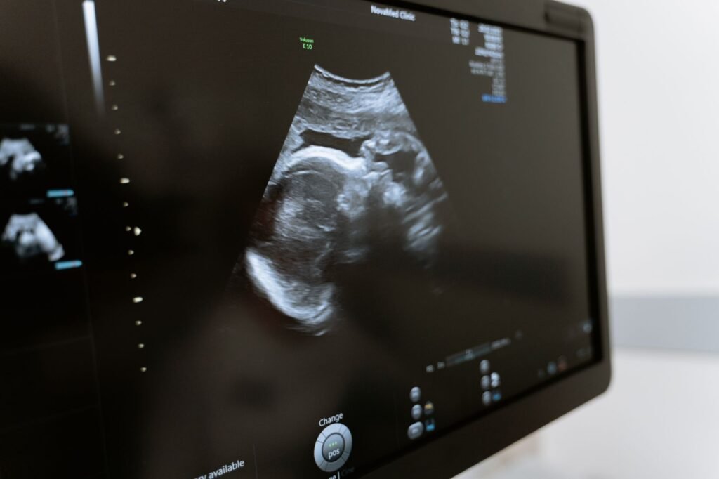 An expectant parent looking at an early ultrasound image